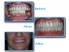find prosthodontist in Algodones for full mouth rehabilitation