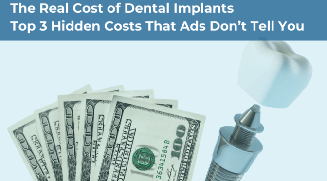 Real Cost of Dental Implants