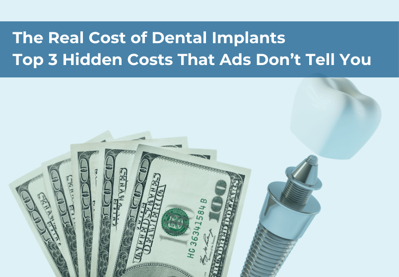 Real Cost of Dental Implants